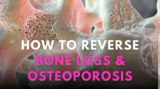 Understanding osteoporosis and the benefits of plant-based calcium – Dr. Dobias Natural Healing